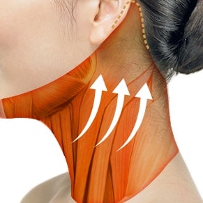 High-SMAS Necklift
